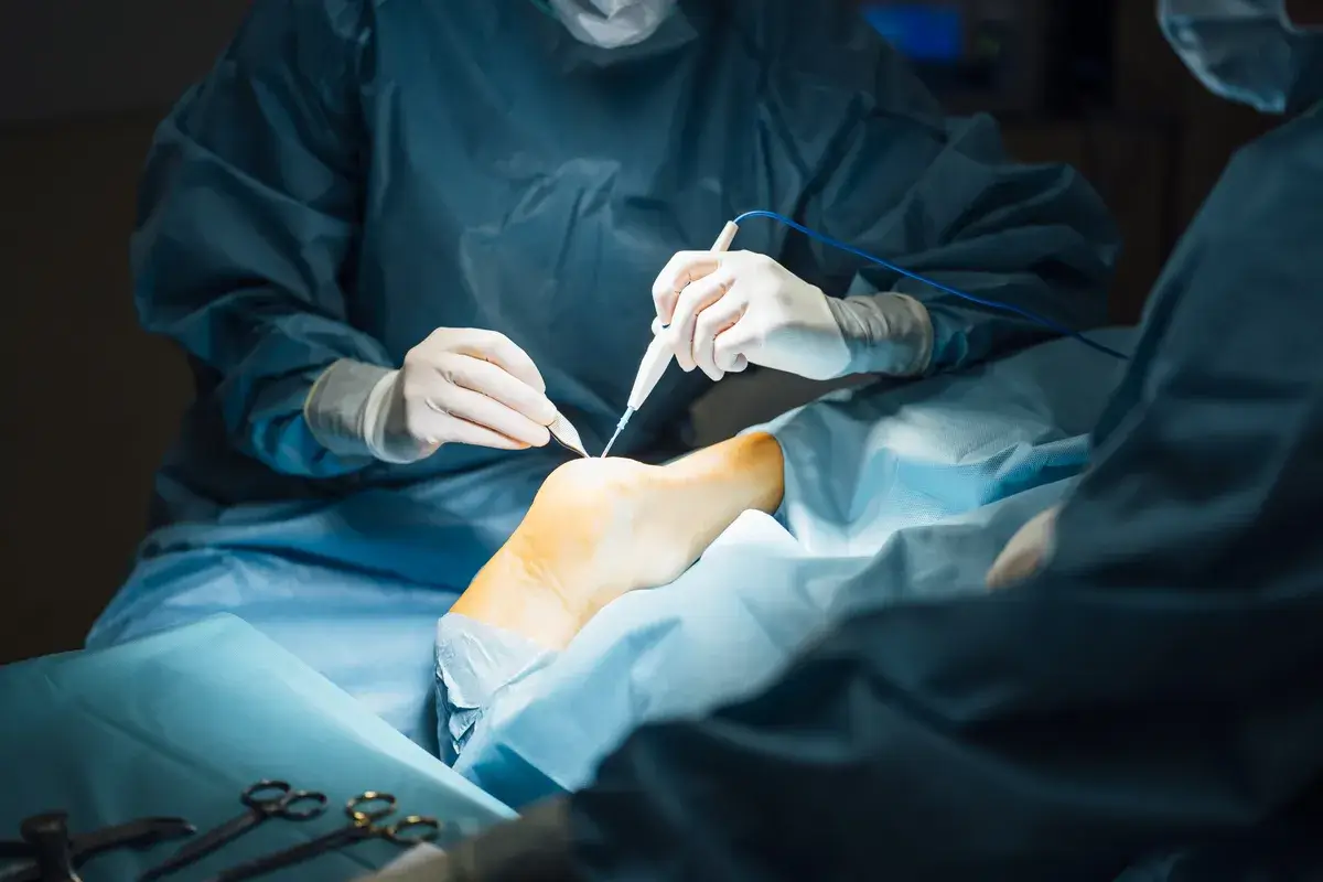 surgeons-and-nurse-during-a-foot-surgery