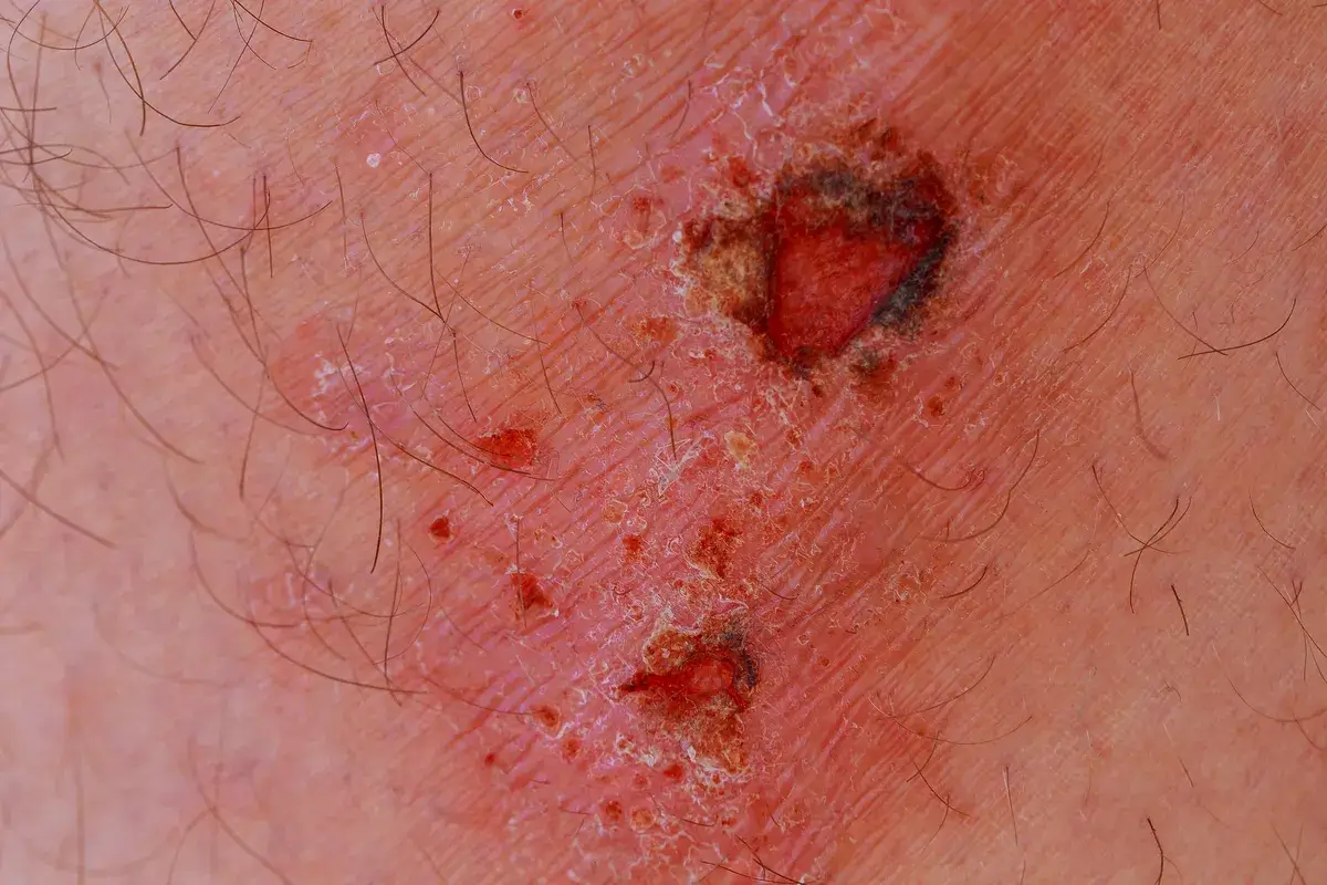 man-with-a-wound-on-his-knee-wound