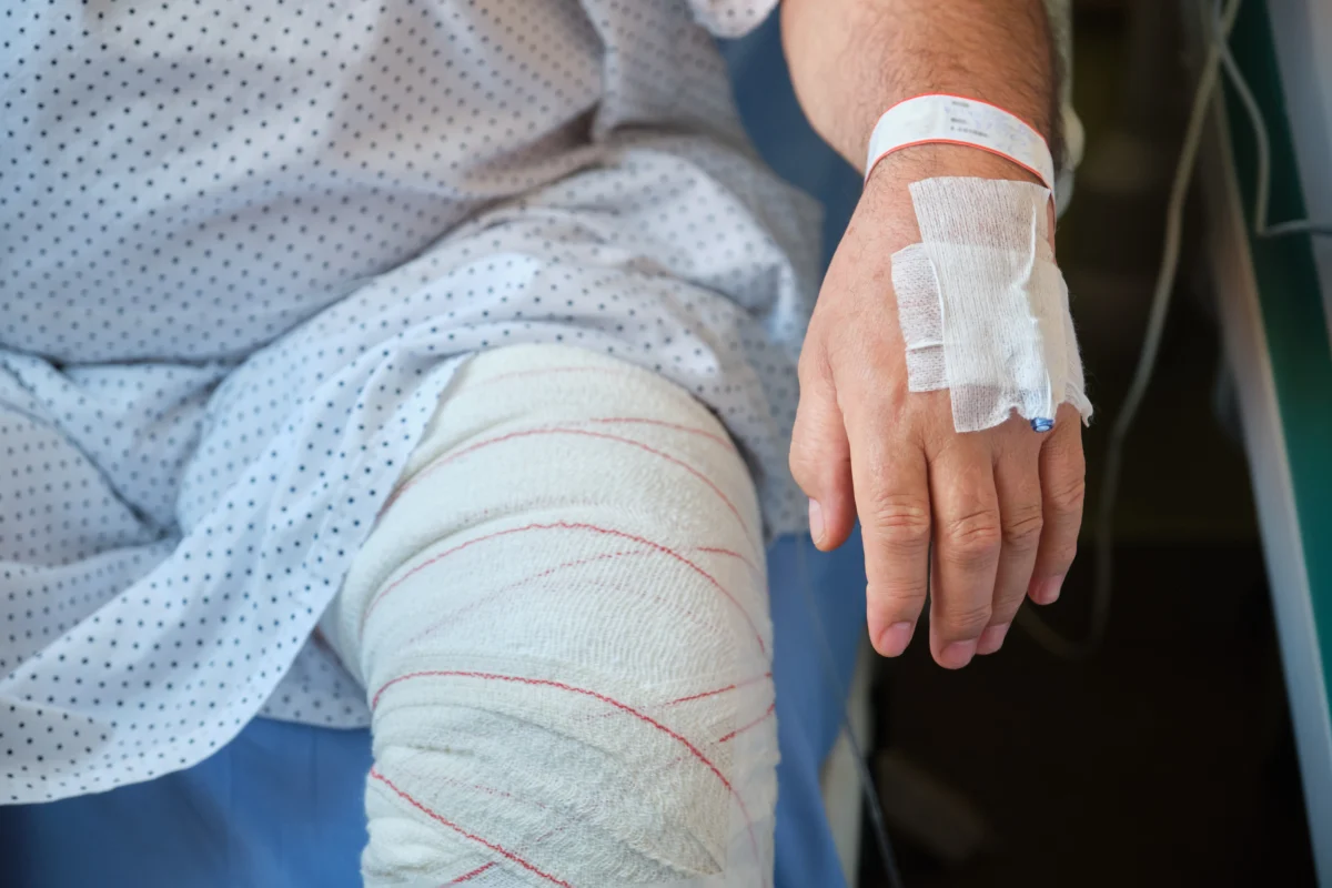 bandaged-leg-and-arm
